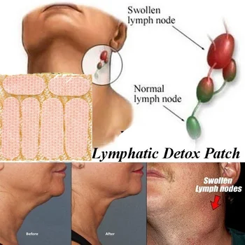 5 Škvrny Organickými Lymfodrenáž Detox Patch Anti-Opuch Patch Účinné Bezbolestné Ošetrenie Zväčšenie Lymfatických Uzlín Patch