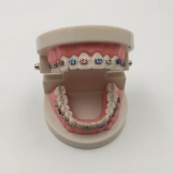 Vysoká Kvalita Orthodontics Model pre Zubný lekár, Dentálna 1/2 Standard Chrup s Full Metal Zátvorkách Zuby Model