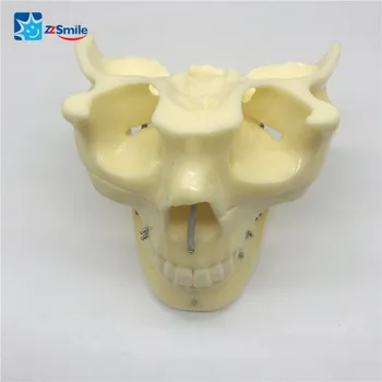 Zubné M2016 Plastové Implantát Praxi Model Zubné Model