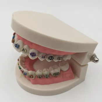 Vysoká Kvalita Orthodontics Model pre Zubný lekár, Dentálna 1/2 Standard Chrup s Full Metal Zátvorkách Zuby Model